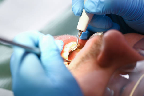 Best Urgent Tooth Repair  in Fitchburg, MA