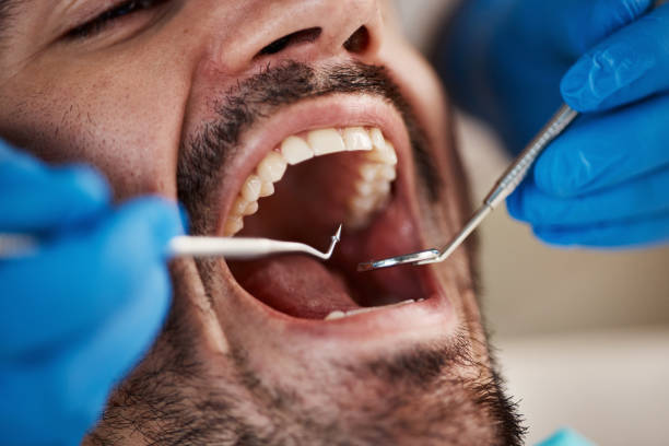 Best Cracked Tooth Emergency Dentist  in Fitchburg, MA
